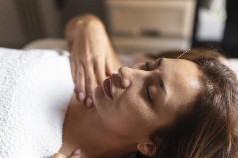 Acupuncture: Benefits, Conditions Treated, and What to Expect